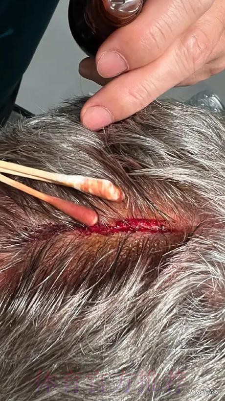 安帅:对红牌感到困扰 今天发生了我们没碰到过的事